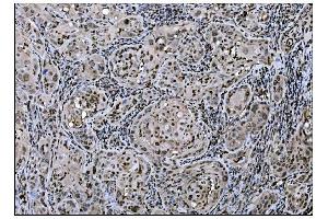 IHC analysis of Fos B/FOSB using anti-Fos B/FOSB antibody (ABIN7599279). (FOSB anticorps  (AA 1-332))