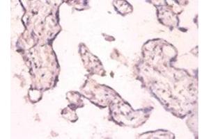 Immunohistochemistry of paraffin-embedded human placenta tissue using ABIN7159368 at dilution of 1:100 (PKMYT1 anticorps  (AA 900-1101))