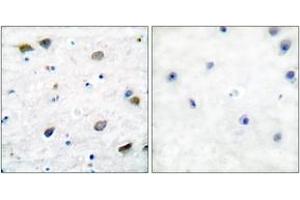 Immunohistochemistry analysis of paraffin-embedded human brain tissue, using GABA-RB (Ab-434) Antibody. (GABA-RB (AA 401-450) anticorps)