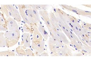 Detection of MAPK6 in Human Cardiac Muscle Tissue using Polyclonal Antibody to Mitogen Activated Protein Kinase 6 (MAPK6) (MAPK6 anticorps  (AA 1-316))
