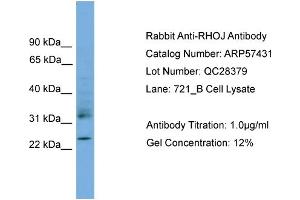 WB Suggested Anti-RHOJ  Antibody Titration: 0. (RHOJ anticorps  (Middle Region))