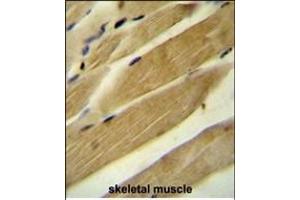 RPH3AL Antibody (C-term) (ABIN654698 and ABIN2844391) immunohistochemistry analysis in formalin fixed and paraffin embedded human skeletal muscle followed by peroxidase conjugation of the secondary antibody and DAB staining. (RPH3AL anticorps  (C-Term))