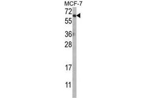 Western blot analysis of AKT1 Antibody (N-term) in MCF-7 cell line lysates (35ug/lane). (AKT1 anticorps  (N-Term))