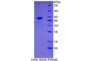SDS-PAGE analysis of Mouse EGR4 Protein. (EGR4 Protéine)