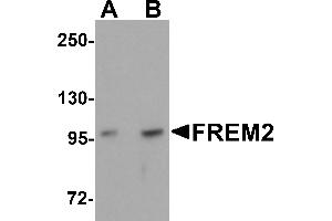Western Blotting (WB) image for anti-Fras1 Related Extracellular Matrix Protein 2 (FREM2) (Middle Region) antibody (ABIN1030933) (FREM2 anticorps  (Middle Region))