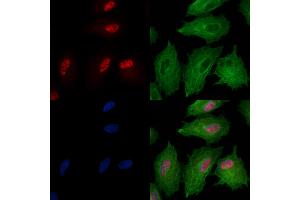 Phospho-SIRT6 (Ser10) Antibody staining A549 cells(heat shock treatment) by IF/ICC. (SIRT6 anticorps  (pSer10))