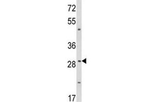 Western blot analysis of TTP antibody and WiDr lysate (ZFP36 anticorps  (AA 116-142))