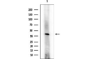 anti-Inhibin, beta B (INHBB) (Internal Region) antibody