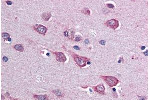 anti-Suppressor of Cytokine Signaling 1 (SOCS1) (C-Term) antibody