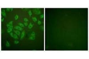 anti-Cystatin A (Stefin A) (CSTA) (C-Term) antibody