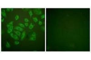 Immunofluorescence analysis of A549 cells, using Stefin A antibody. (CSTA anticorps  (C-Term))
