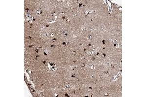 Immunohistochemical staining of human cerebral cortex with CKAP5 polyclonal antibody  shows strong cytoplasmic positivity in neuronal cells. (CKAP5 anticorps)