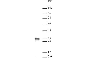 MGMT antibody (pAb) tested by Western blot. (MGMT anticorps  (C-Term))