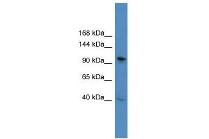 WB Suggested Anti-BCL11B Antibody Titration: 0. (BCL11B anticorps  (C-Term))