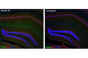 Immunohistochemistry (IHC) image for anti-Solute Carrier Family 4, Sodium Bicarbonate Cotransporter, Member 8 (SLC4A8) (AA 1078-1089) antibody (ABIN1742538)