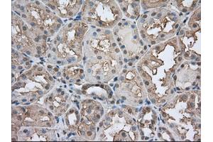 Immunohistochemical staining of paraffin-embedded Human prostate tissue using anti-BSG mouse monoclonal antibody. (CD147 anticorps)