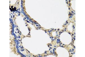 Immunohistochemistry of paraffin-embedded Rat lung using IL36G Polyclonal Antibody at dilution of 1:100 (40x lens). (IL1F9 anticorps)