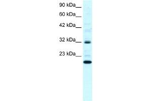 WB Suggested Anti-ARHGDIG Antibody Titration:  0. (ARHGDIG anticorps  (N-Term))