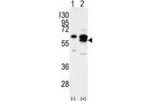 Western Blotting (WB) image for anti-Calcium/calmodulin-Dependent Protein Kinase IG (CAMK1G) antibody (ABIN3003080) (CAMK1G anticorps)