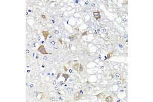 Immunohistochemistry of paraffin-embedded rat brain using PSPH antibody at dilution of 1:100 (x40 lens). (PSPH anticorps)