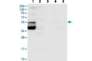 Western blot analysis of Lane 1: RT-4, Lane 2: U-251 MG, Lane 3: Human Plasma, Lane 4: Liver, Lane 5: Tonsil with SLC38A7 polyclonal antibody  at 1:250-1:500 dilution. (Solute Carrier Family 38, Member 7 (SLC38A7) anticorps)
