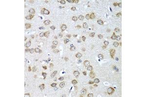 Immunohistochemistry of paraffin-embedded mouse brain using EIF1AX antibody. (EIF1AX anticorps  (AA 10-144))