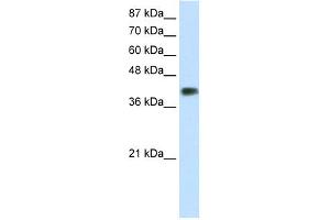 WB Suggested Anti-DLX3 Antibody Titration:  1. (DLX3 anticorps  (C-Term))