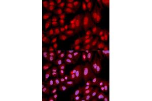 Immunofluorescence analysis of U2OS cell using PPP2R2A antibody. (PPP2R2A anticorps)