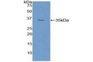 Western blot analysis of recombinant Mouse FCN1. (FCN1 anticorps  (AA 25-317))