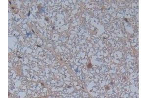 Detection of F13A1 in Rat Spinal cord Tissue using Polyclonal Antibody to Coagulation Factor XIII A1 Polypeptide (F13A1)