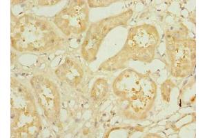 Immunohistochemistry of paraffin-embedded human kidney tissue using ABIN7157306 at dilution of 1:100 (KLHDC5 anticorps  (AA 1-410))