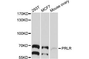 Western blot analysis of extracts of various cell lines, using PRLR antibody (ABIN4904864) at 1:1000 dilution.