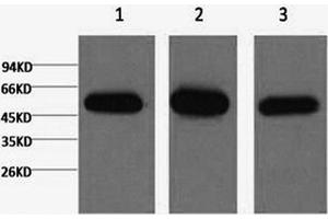 Western Blotting (WB) image for anti-Tubulin, beta 1 (TUBB1) antibody (ABIN5956137) (TUBB1 anticorps)