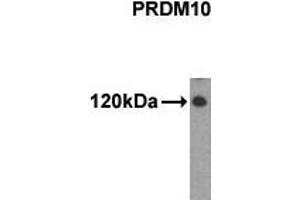 Western Blotting (WB) image for anti-PR Domain Containing 10 (PRDM10) (N-Term) antibody (ABIN356377) (PRDM10 anticorps  (N-Term))