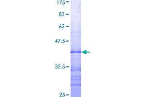 BCL2-Associated Agonist of Cell Death (BAD) (AA 69-168) protein (GST tag)
