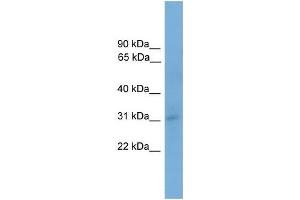 Human 293T; WB Suggested Anti-TAPBP Antibody Titration: 0. (TAPBP anticorps  (N-Term))