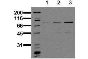 Western Blotting (WB) image for anti-Signal Transducer and Activator of Transcription 1, 91kDa (STAT1) (phosphorylated) antibody (ABIN126895)
