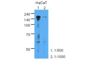 The extracts of HaCaT (35 ug) were resolved by SDS-PAGE, transferred to PVDF membrane and probed with anti-human EGFR (1:500 or 1000). (EGFR anticorps  (AA 424-605))