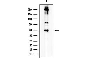 Western blot analysis of lysates from Rat brain, using c-Myc Mouse Monoclonal Antibody at 1/1000 dilution.