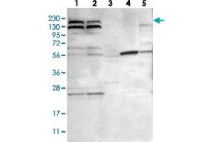 Western blot analysis of Lane 1: RT-4, Lane 2: U-251 MG, Lane 3: Human Plasma, Lane 4: Liver, Lane 5: Tonsil with PARP14 polyclonal antibody  at 1:250-1:500 dilution. (PARP14 anticorps)