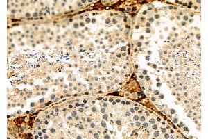 ABIN6262237 and ABIN6278474 at 1/100 staining Mouse lung tissue by IHC-P.