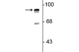 Western blot of rat lung lysate showing specific immunolabeling of the ~93 kDa periostin protein doublet. (Periostin anticorps  (C-Term))