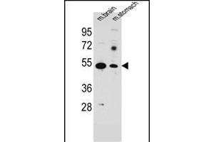 SLC16A11 Antibody (N-term) (ABIN654868 and ABIN2844526) western blot analysis in mouse brain,stomach tissue lysates (35 μg/lane).