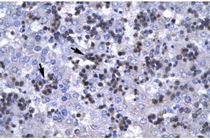Human Liver; RBPSUH antibody - C-terminal region in Human Liver cells using Immunohistochemistry (RBPJ anticorps  (C-Term))
