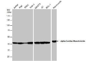 WB Image alpha Cardiac Muscle Actin antibody detects alpha Cardiac Muscle Actin protein by western blot analysis.