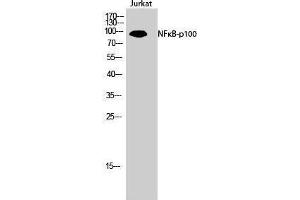 Western Blotting (WB) image for anti-Nuclear Factor of kappa Light Polypeptide Gene Enhancer in B-Cells 2 (NFKB2) (Thr160) antibody (ABIN3176319) (NFKB2 anticorps  (Thr160))