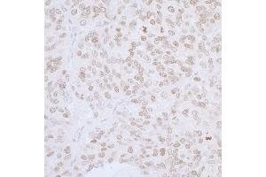 Immunohistochemistry (IHC) image for anti-Thymopoietin (TMPO) (AA 200-250) antibody (ABIN7453438)