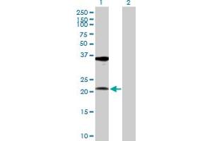 Western Blot analysis of RPL10A expression in transfected 293T cell line by RPL10A MaxPab polyclonal antibody. (RPL10A anticorps  (AA 1-217))