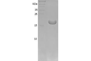 Western Blotting (WB) image for Interleukin 1, beta (IL1B) (AA 115-267) protein (His tag) (ABIN7123535)