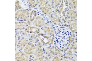 Immunohistochemistry of paraffin-embedded mouse kidney using CGB7 antibody (ABIN5974696) at dilution of 1/100 (40x lens). (CGB7 anticorps)